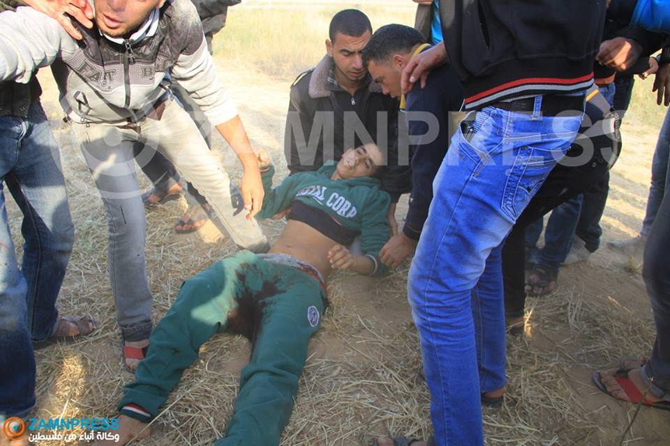 بالصور.. إصابة شاب بجروح متوسطة شرق خان يونس صورة الجريح