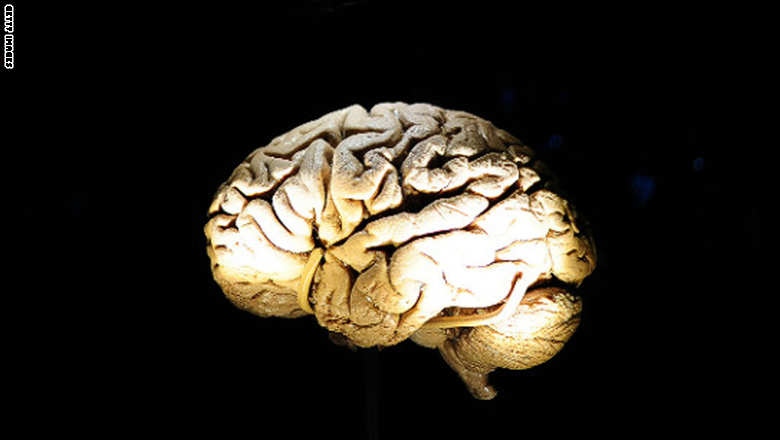 سماعة تحول الدماغ إلى بطارية تعيد شحنك بالطاقة وتعدّل مزاجك دماغ