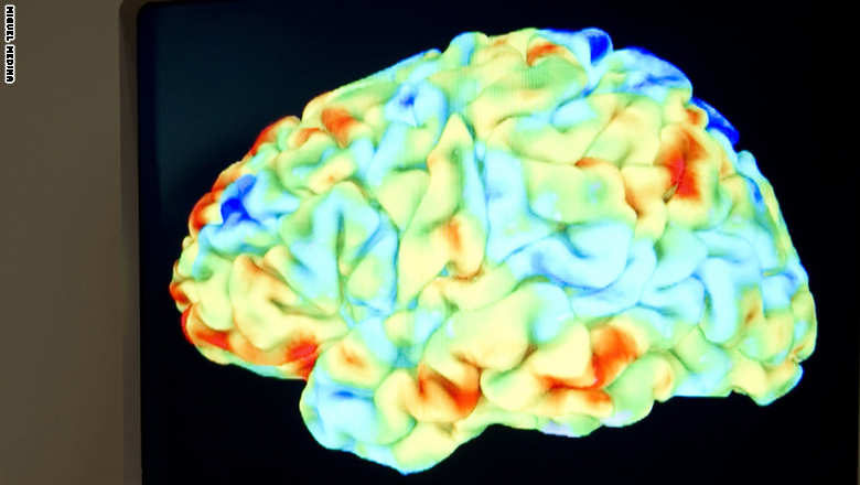 هل الإكثار من مشاهدة الأفلام الإباحية يؤثر على المخ ؟ دماغ إنسان