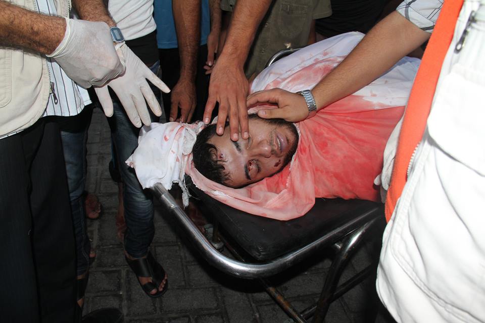 استشهاد صحفي وإصابة عدة مواطنين في قصف شرق الشجاعية مرتجى