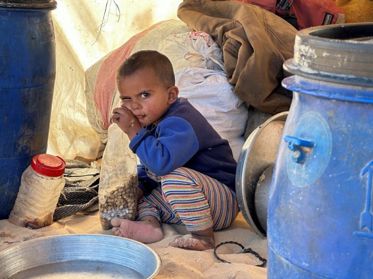 “المجاعة تتسارع بغزة”.. الإعلام الحكومي بالقطاع: 3500 طفل يهددهم الموت جراء سوء التغذية