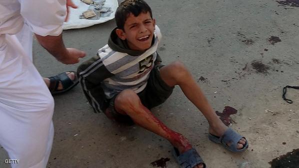 طفل اصيب بالتفجير