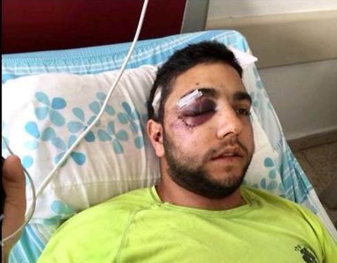 التنكيل بجندي إسرائيلي لأنه تحدث العربية جندي اسرائيل