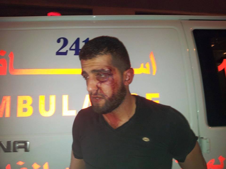 بالصور: الوقائي يعتدي على شاب وزوجته بالضرب المبرح الامن الوقائي