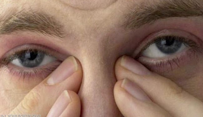 رجل أصيب بالعمى بسبب عمل نفعله يومياً.. ما هو؟ عمل يومي