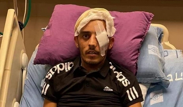 استشهاد شاب مقدسي متأثرا باصابته برصاص الاحتلال