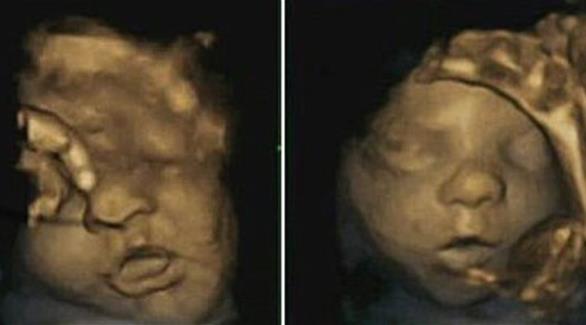 الجنين يتمرن على الابتسام استعداداً للقاء والديه جنين