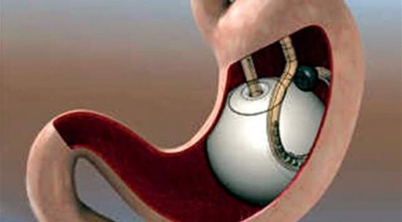 كبسولة تنقص الوزن 13 إلى 15 كغم خلال أسابيع كبسولة