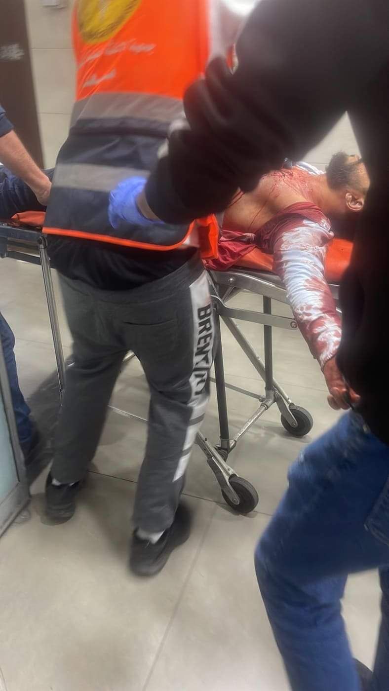 محدث بالفيديو والصور 4 شهداء و19 إصابة بينها حرجة برصاص الاحتلال في نابلس ورام الله