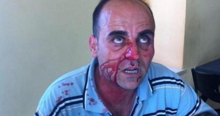 الاتحاد الأوروبي يطالب بإجراء تحقيق كامل ومستقل وشفاف في قضية وفاة بنات
