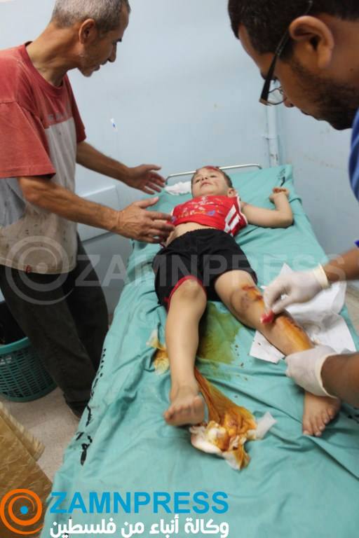 أطباء وحقوقيون: إسرائيل تستهدف مدنيي غزة بأسلحة محرّمة دولياً أطباء وحقوقيون: إسرائيل تستهدف مدنيي غزة بأسلحة محرّمة دولياً