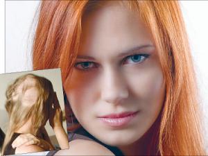 تساقط الشعر