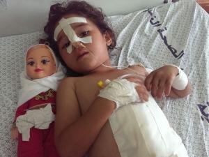 طفلة مصابة خلال الحرب غزة الأخيرة