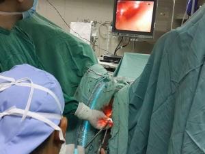 استئصال الأورام