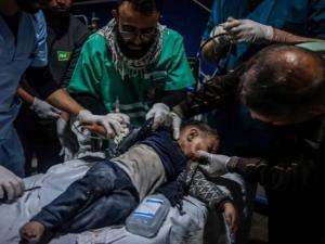 "كنا نتبرع بدمائنا لإنقاذ الجرحى".. شهادات مروعة لأطباء دوليين عملوا في غزة