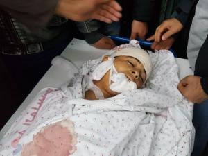 استشهاد طفل فلسطيني برصاص الاحتلال قرب بلدة بيت أمر شمال الخليل
