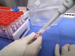 طفرة جديدة تطرأ على كورونا.. وآمال بتحوله إلى "فيروس وديع"