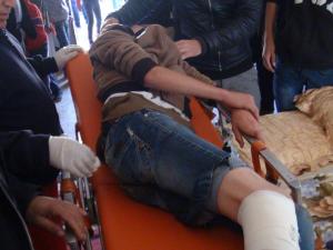 صورة المصاب