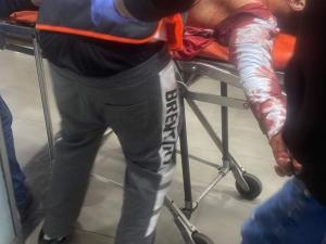 محدث بالفيديو والصور 4 شهداء و19 إصابة بينها حرجة برصاص الاحتلال في نابلس ورام الله