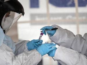نحو مليون و394 ألف حالة وفاة بكورونا حول العالم