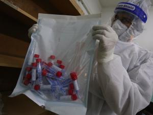 85 اصابة جديدة بفيروس كورونا في غزة